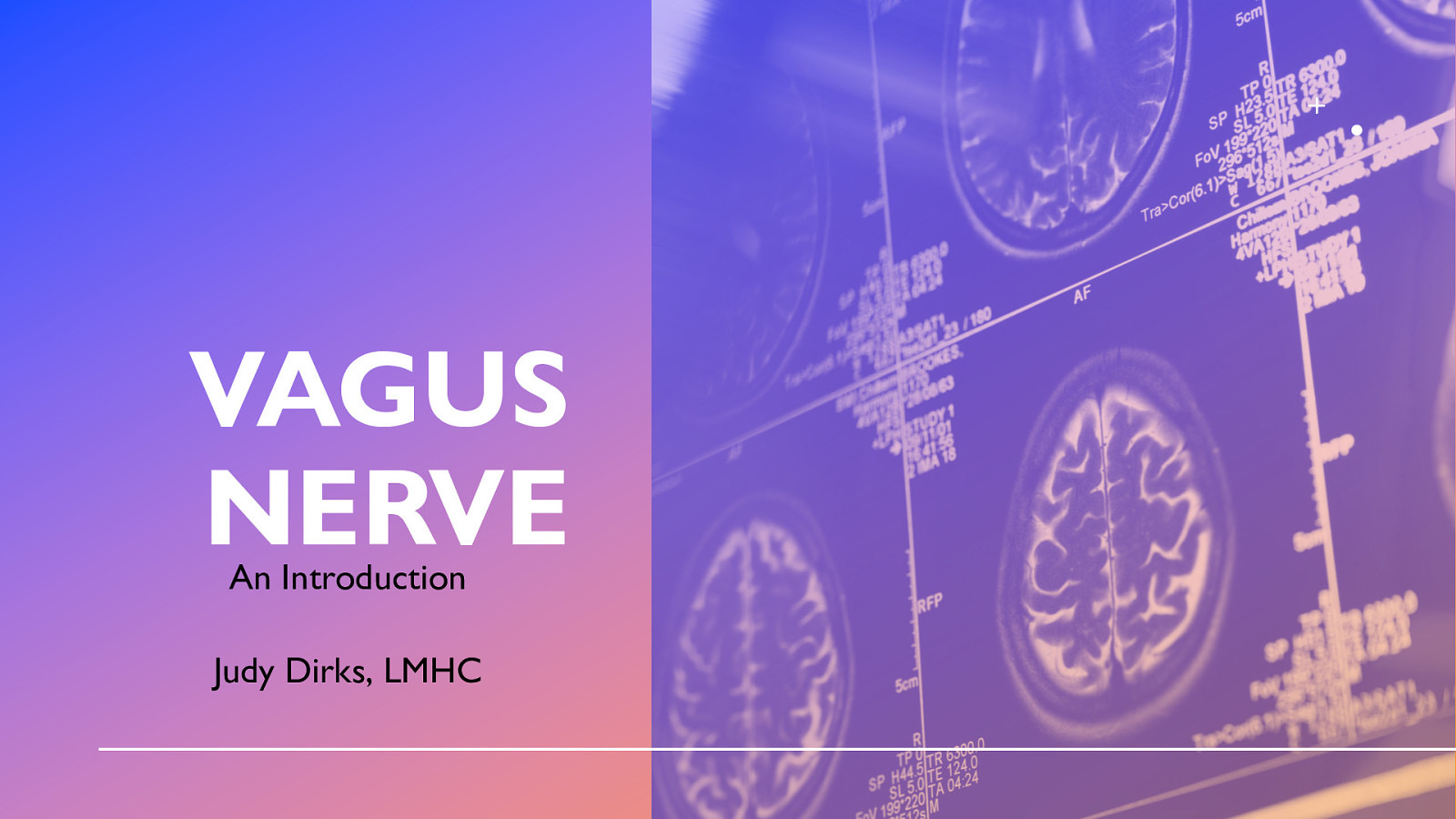 VAGUS NERVE An Introduction Judy Dirks, LMHC